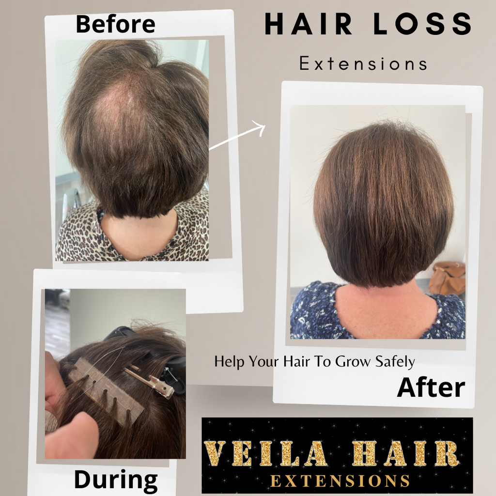 Best Hair Extensions That Help With Hair Loss